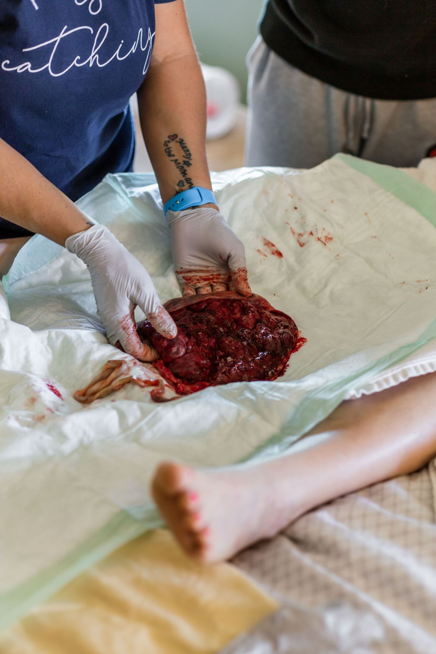 Healthcare worker in blue scrubs handling post-birth placenta on white medical pad.