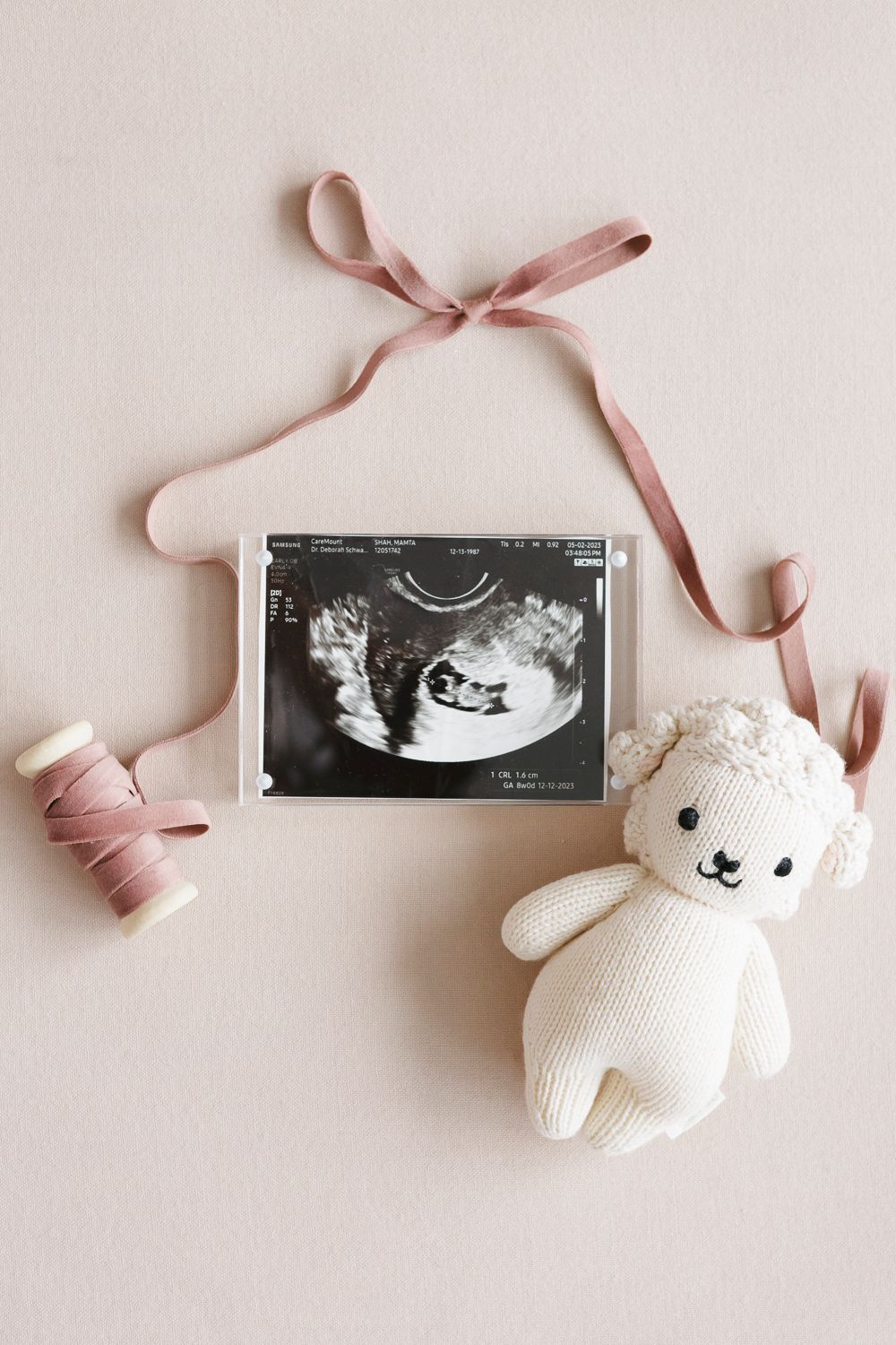 Flatlay of sonogram with toy and bow, captured by NYC newborn photographer Paula Ortiz in the Upper West Side