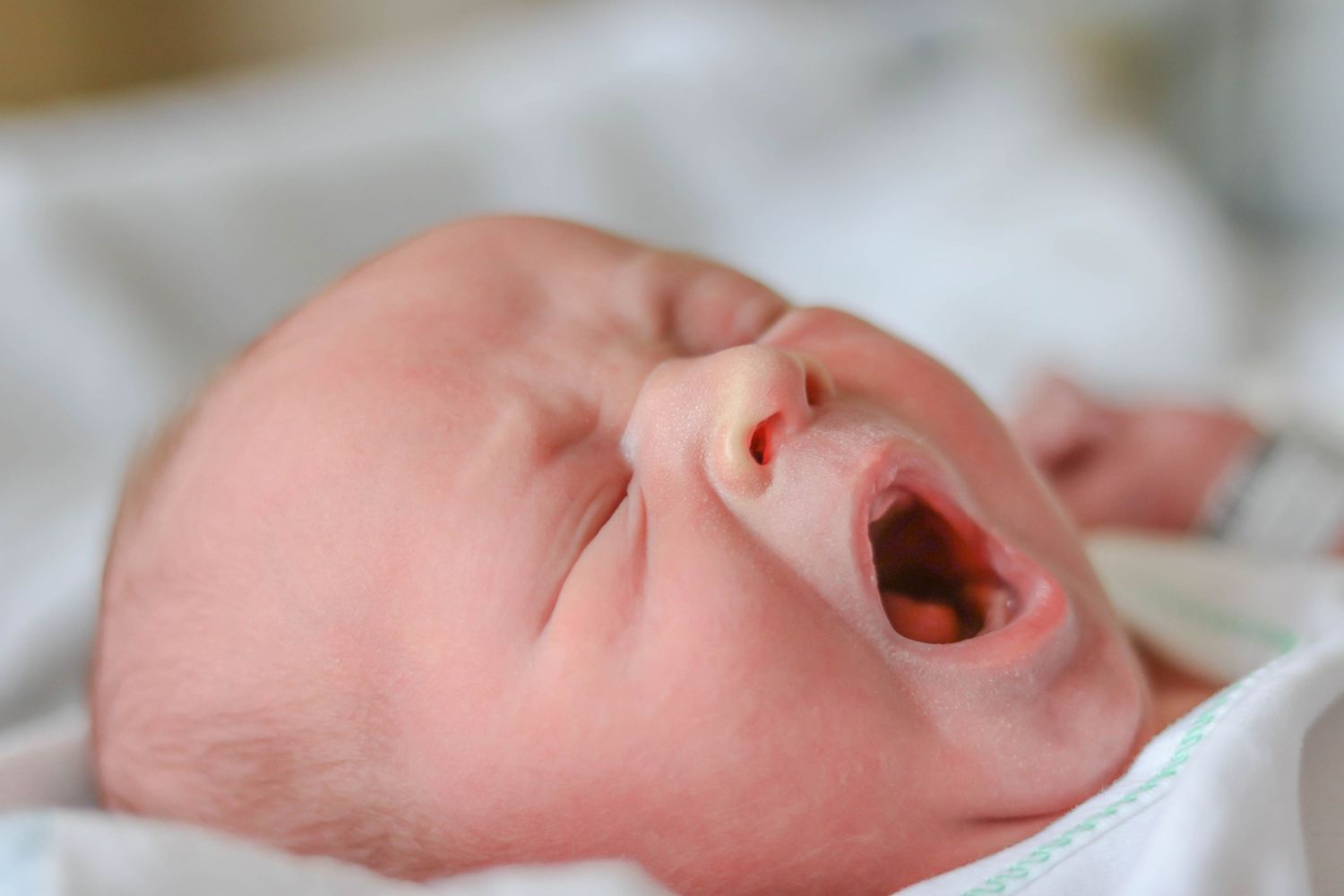 Close-up of yawning newborn baby with soft pink skin against white bedding.