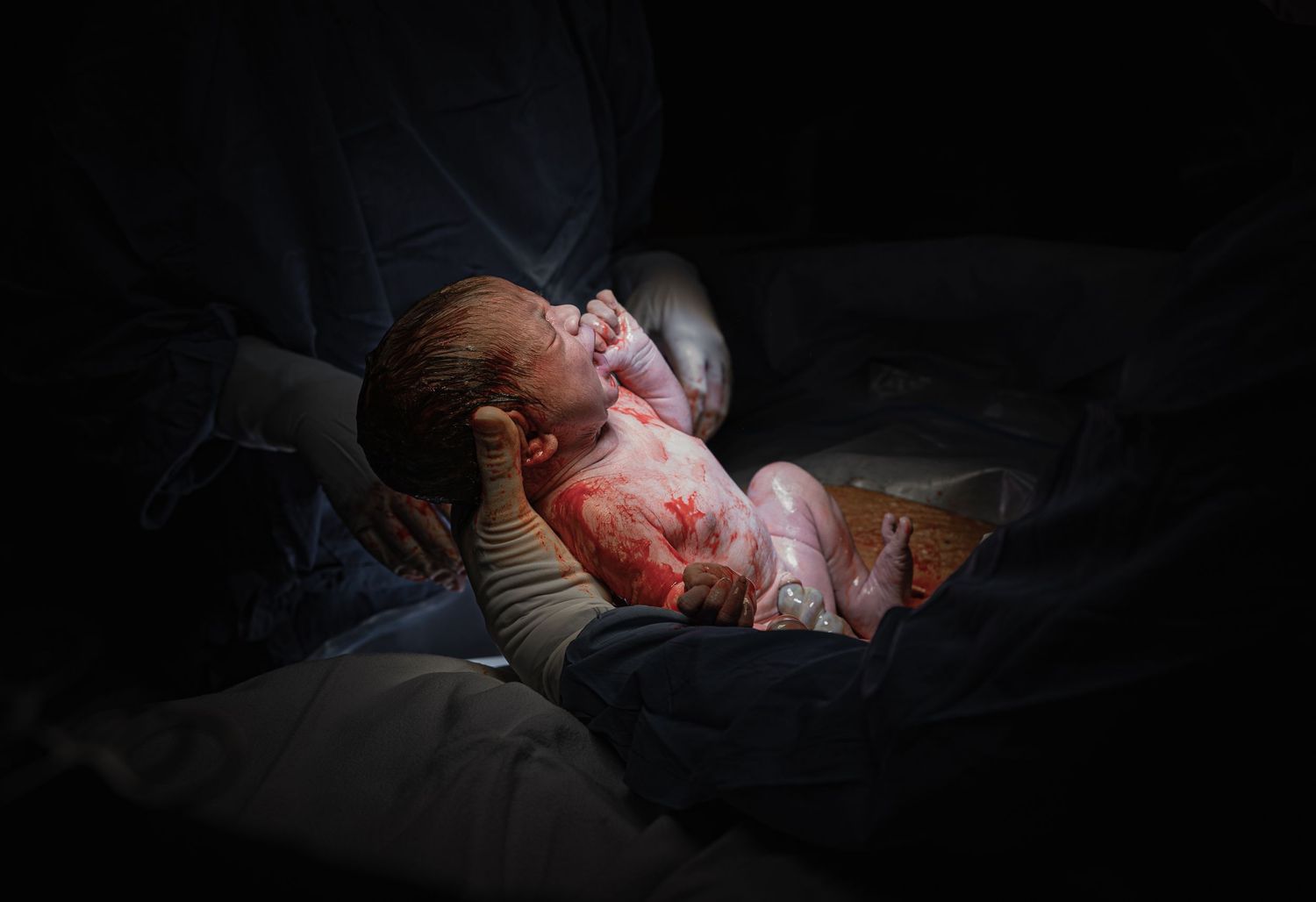 C-section delivery birth photographer cape Town By Grace Photography 1