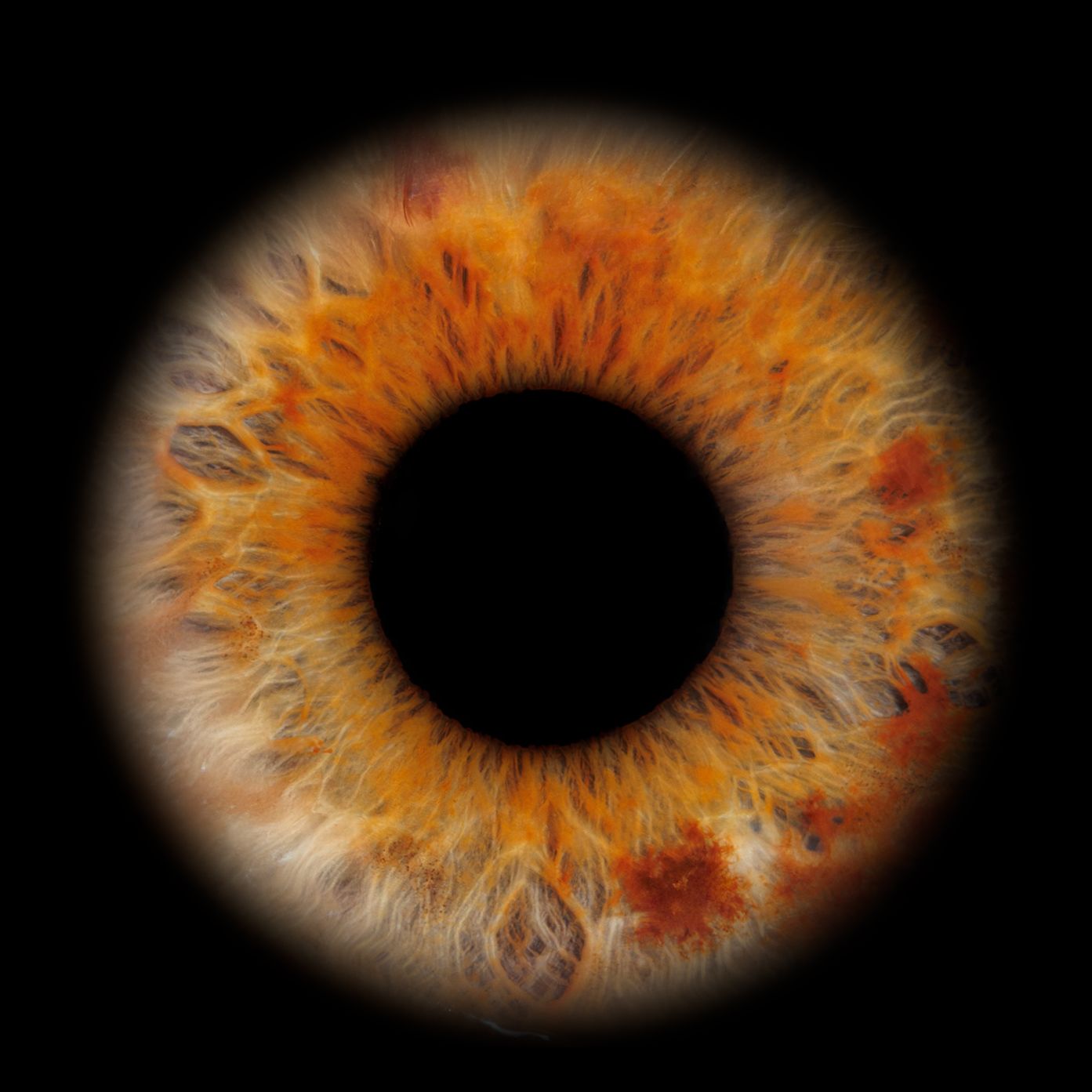 Detailed macro shots showing golden-orange iris texture with intricate patterns around dilating pupil.