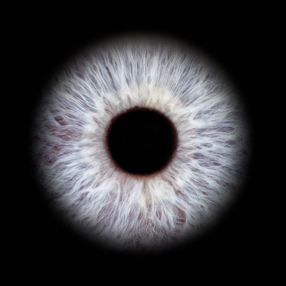 Close-up series showing detailed iris texture and pupil dilation in gray eye with radiating white patterns.