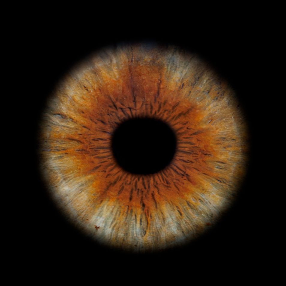 A macro photograph of a vibrant amber-colored human iris with detailed fibrous patterns against a black background.