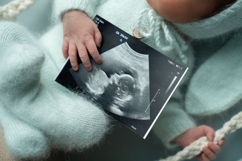 baby photography