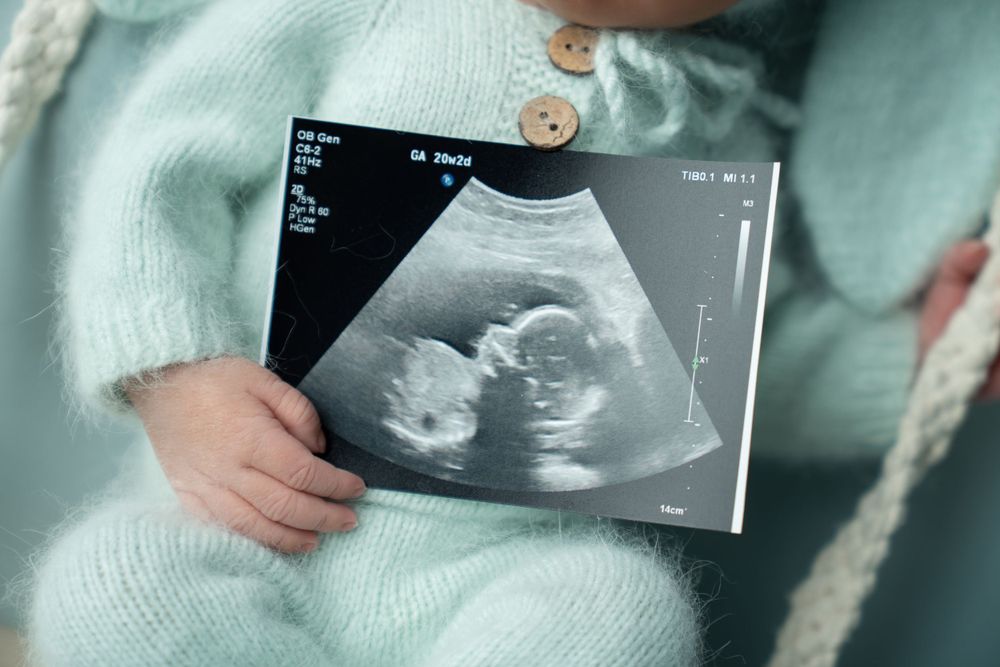 baby photography