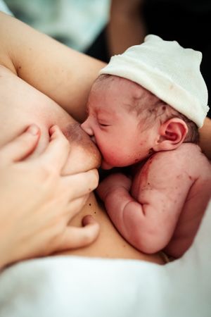 Close-up medical image showing skin-to-skin contact in a clinical setting.