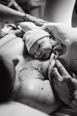 Black and white close-up photograph of a newborn baby in a medical setting.