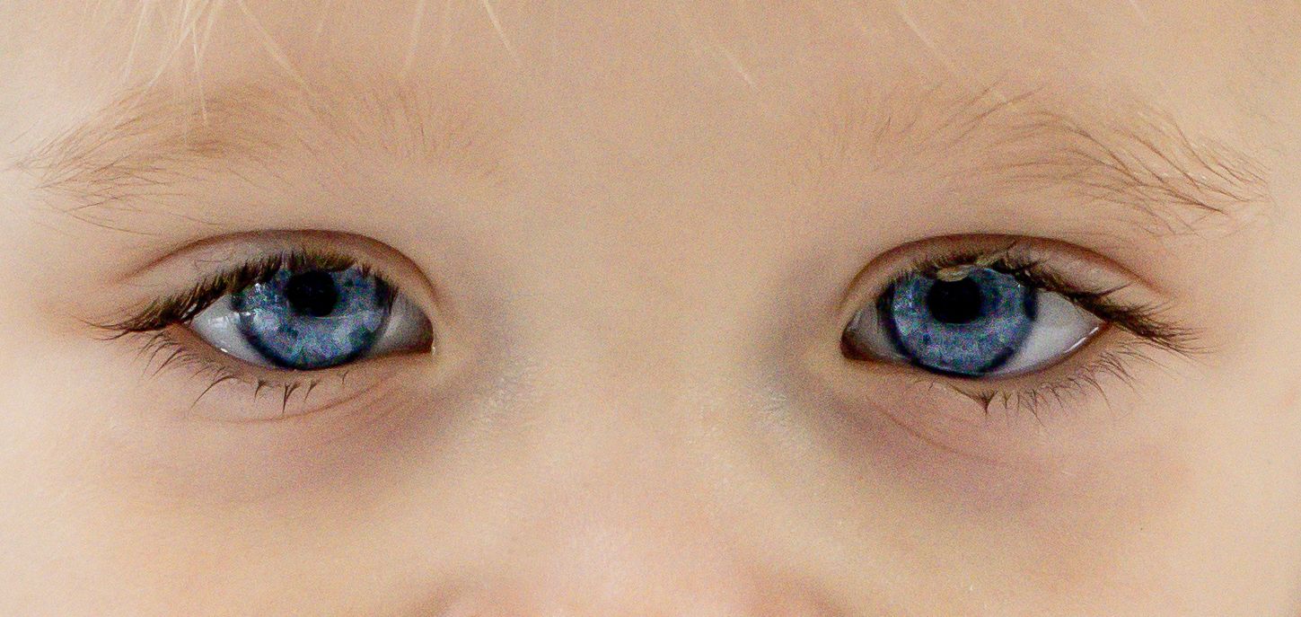 Eyes