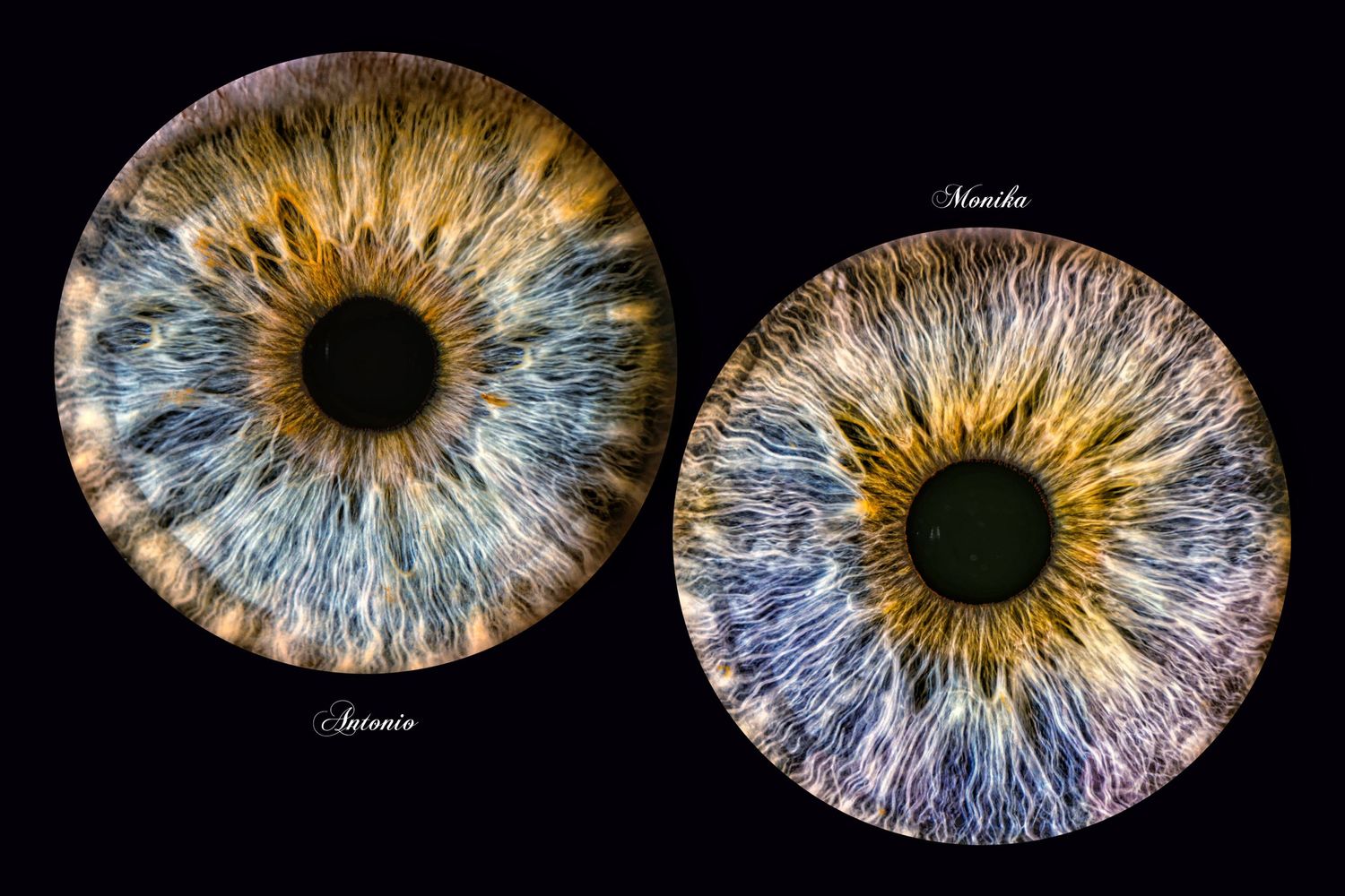 Two detailed macro photographs of blue and gold human irises side by side.