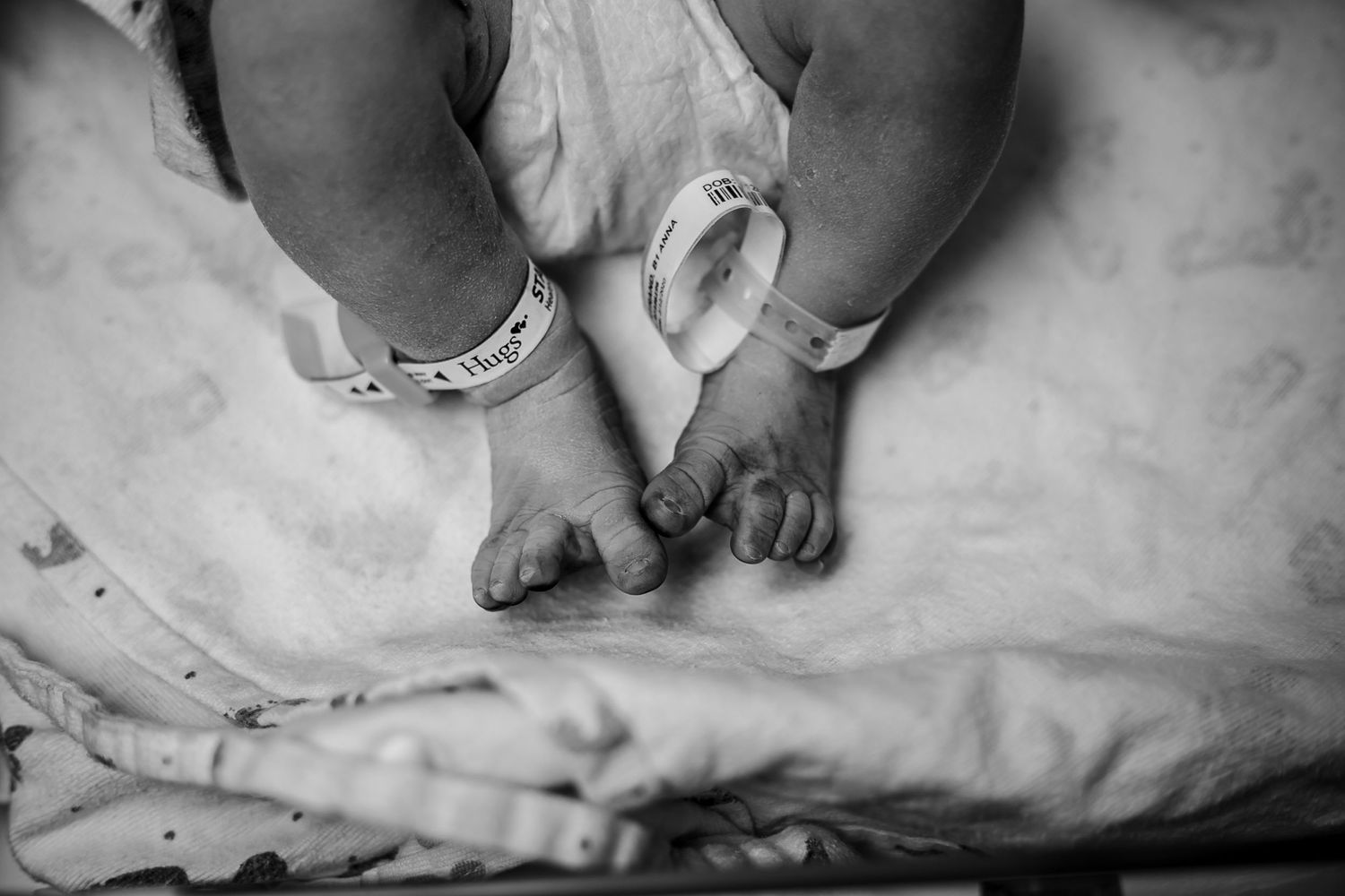 Baby feet just after birth with hospital security bracelets on in Sioux City, IA.