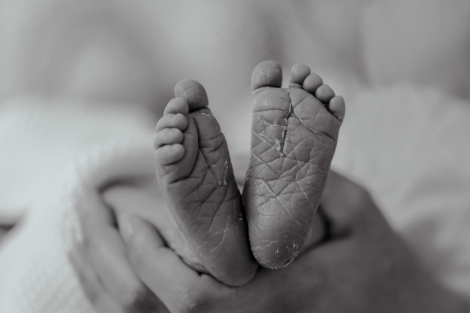 Sort-hvid nærbillede af en nyfødt babys fødder med fin hudtekstur.