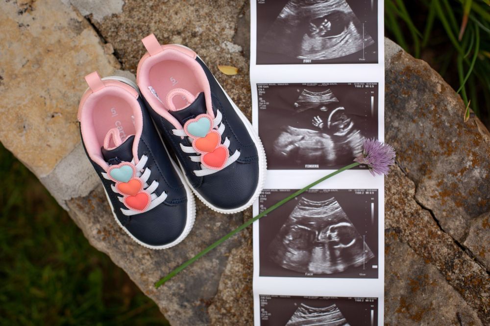 Ultrasound photos and baby shoes posed together for maternity photography session