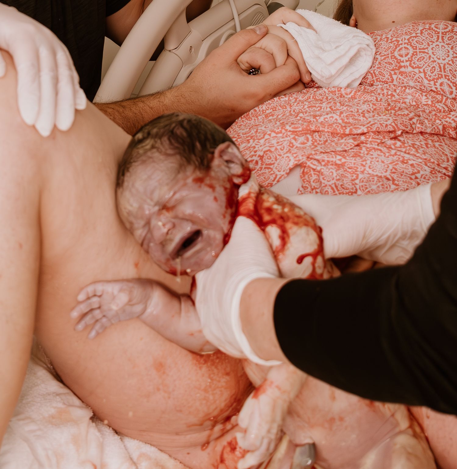 Medical staff assisting during childbirth in hospital delivery room.