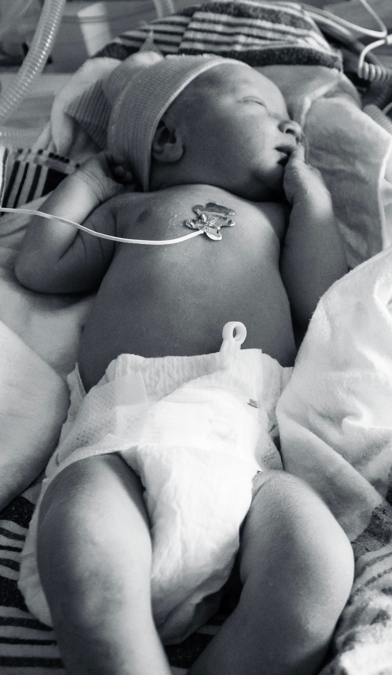 Black and white photo of sleeping newborn with monitoring sensors in hospital.