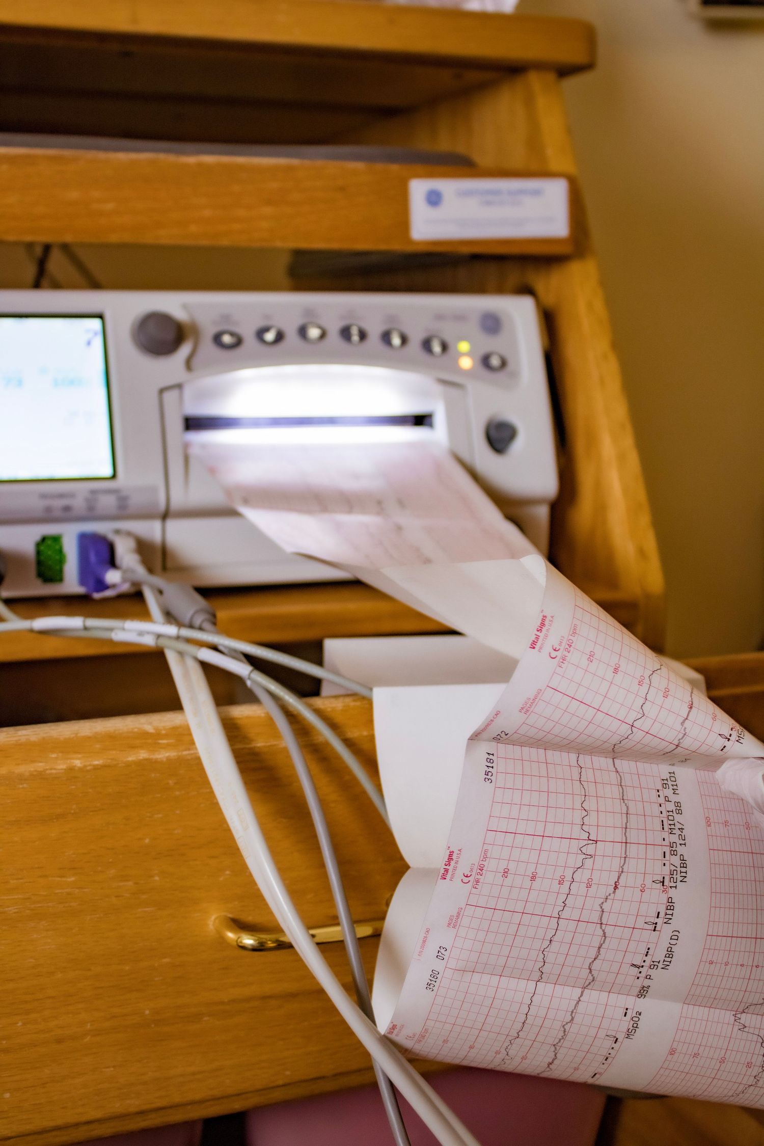 Medical monitoring equipment with printed paper readouts in hospital setting.