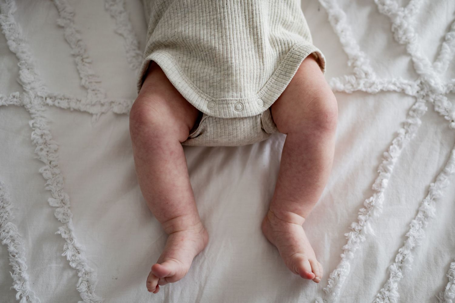 Close-up view of baby legs on textured white bedding.