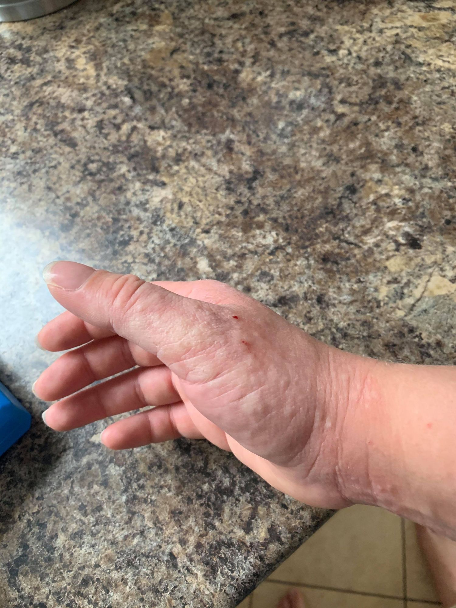 Close-up view of a hand and wrist resting on a marbled granite countertop surface.