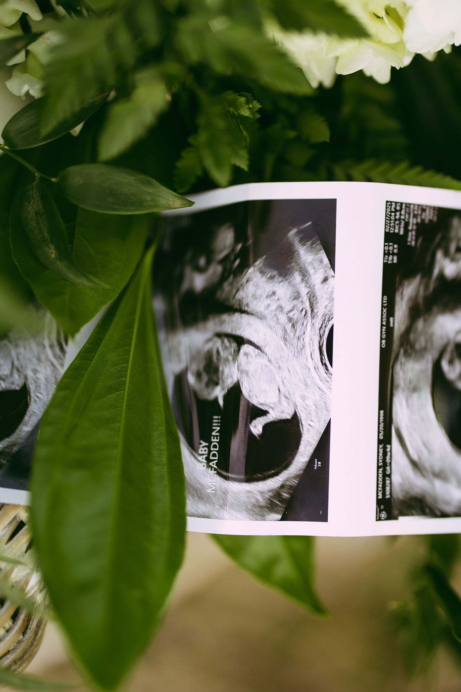 A black and white ultrasound scan photo nestled among green leaves and foliage.