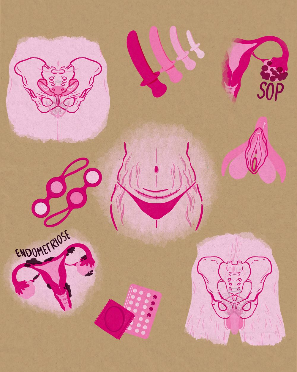 Pink anatomical illustrations and medical icons on tan background paper.