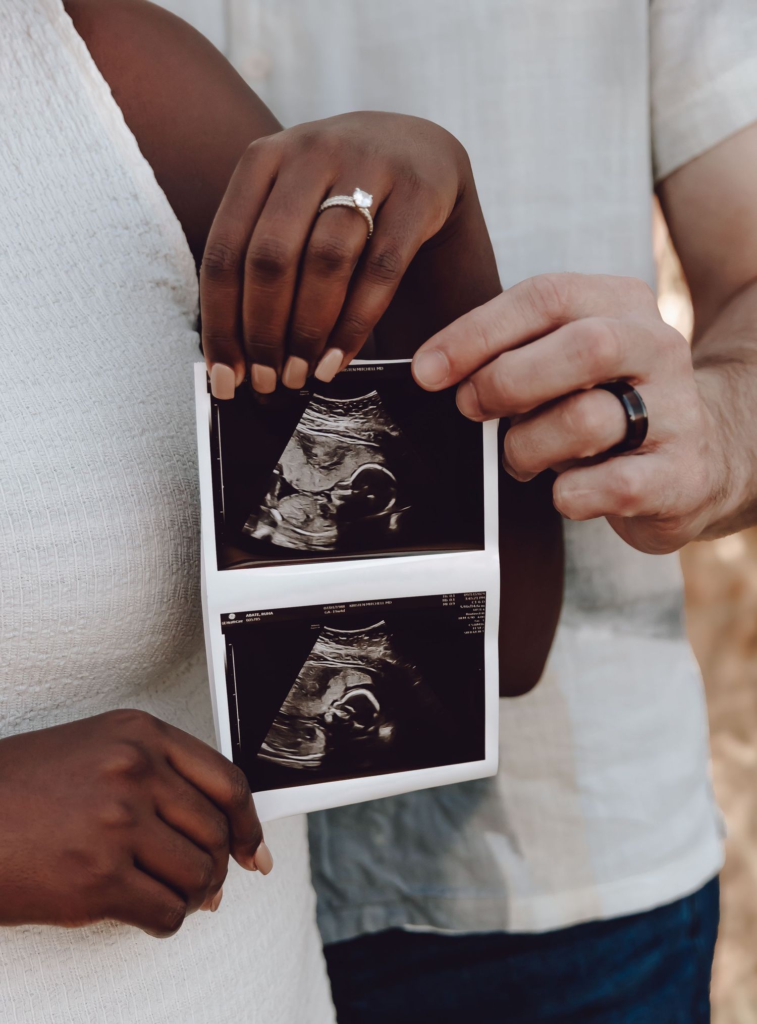 expecting couple sharing their ultrasound photo in new castle, Indiana