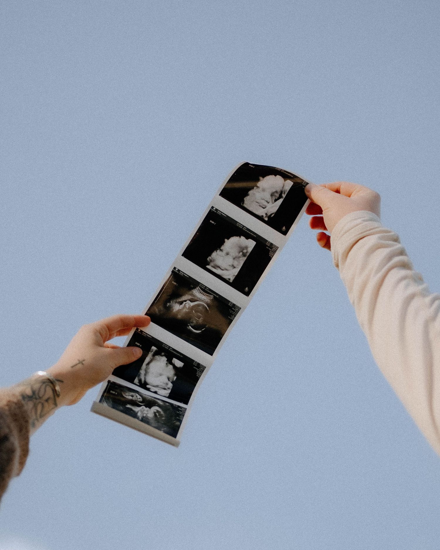 Two hands reach up against a blue sky holding ultrasound scan photos in a strip.