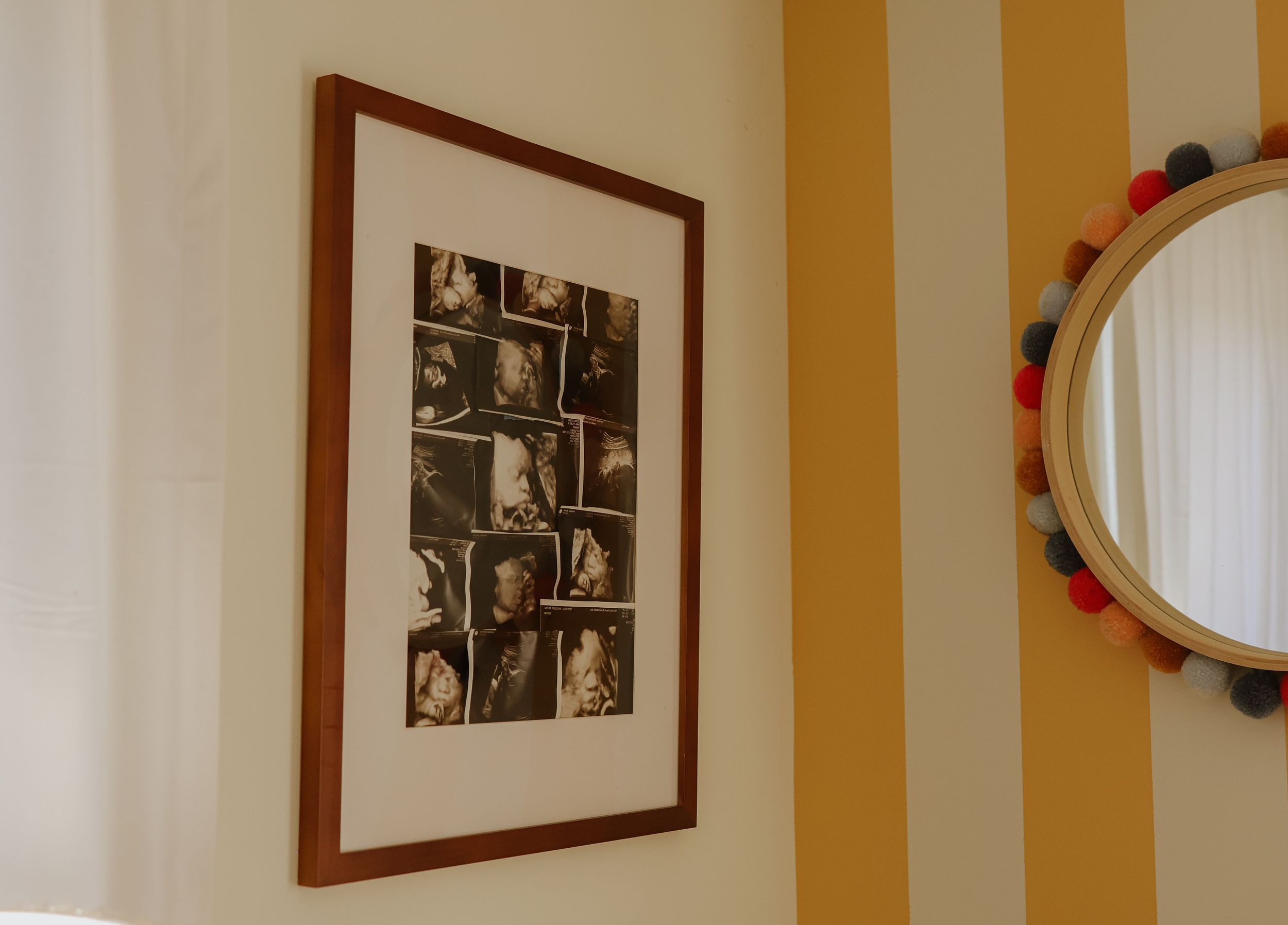 A nursery room with yellow and white striped walls and framed ultrasound photos.