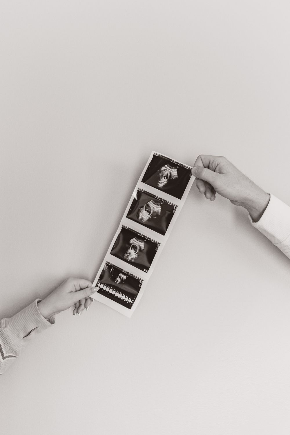 Hands holding ultrasound photos against white background in minimalist style.