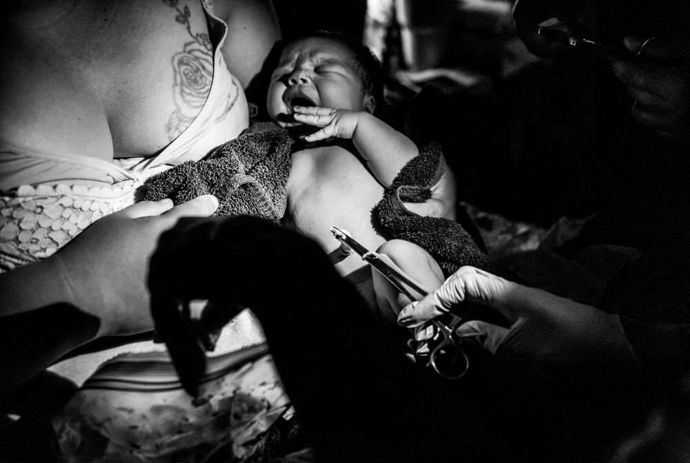 Black and white photo of a crying newborn baby being held and examined by medical professionals after birth.