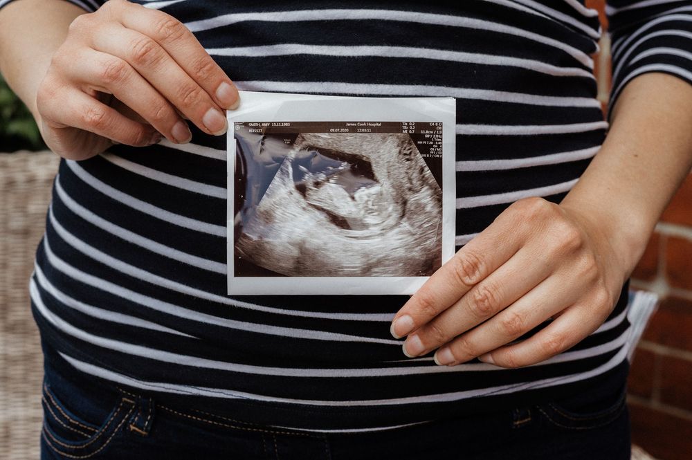 A series of ultrasound photos being held and displayed in someone's hands.