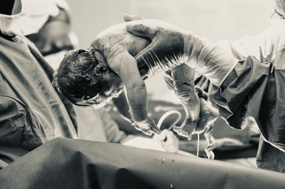 Birth photographer in Constantiaberg Mediclinic. Capturing new life in theatre. First 24hours in hospital. Baby birth photos.