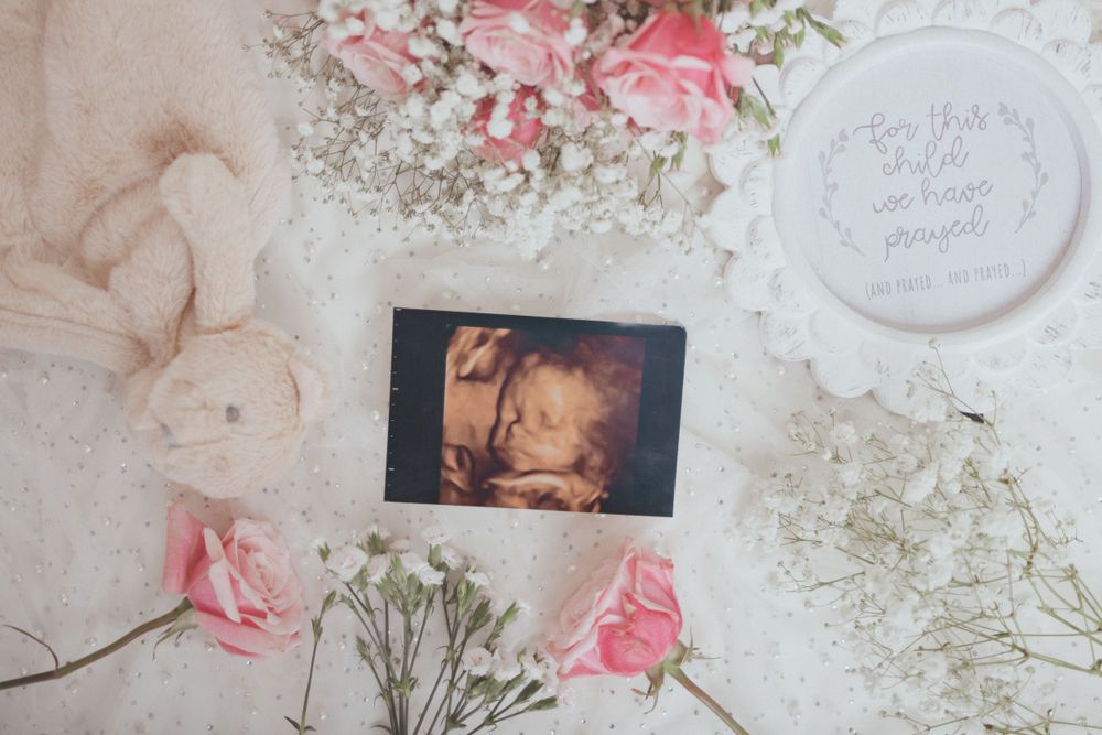 A sonogram photo surrounded by pink roses and baby's breath on a light fabric background.