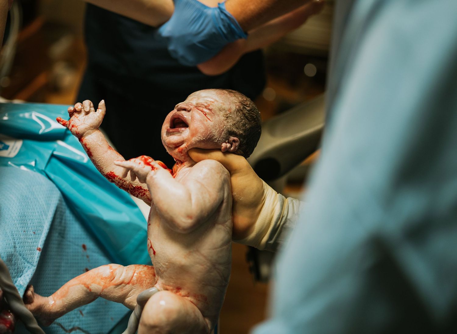 Newborn baby crying during first moments after birth in hospital setting.