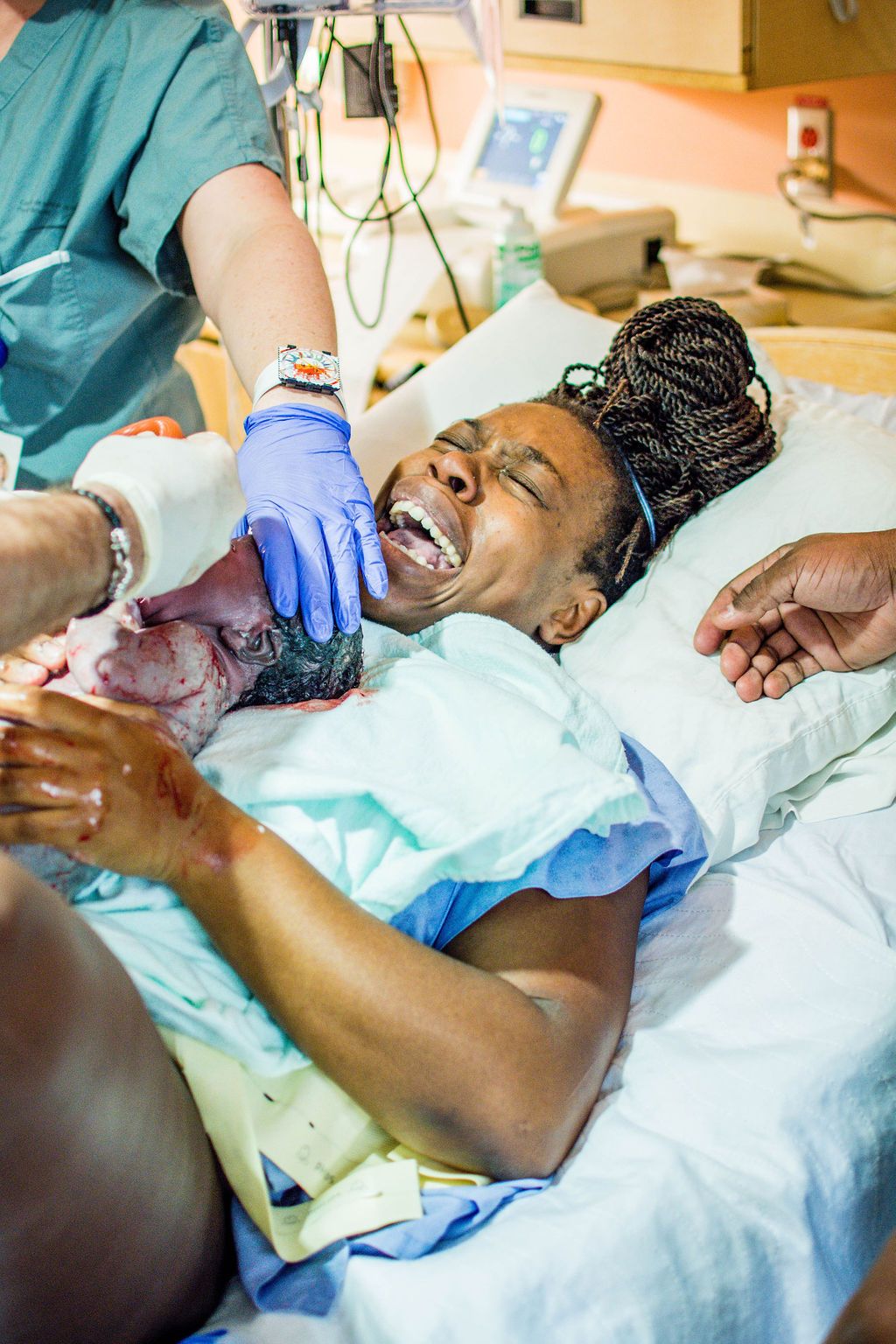 Patient experiencing joyful moment during childbirth while surrounded by medical staff.