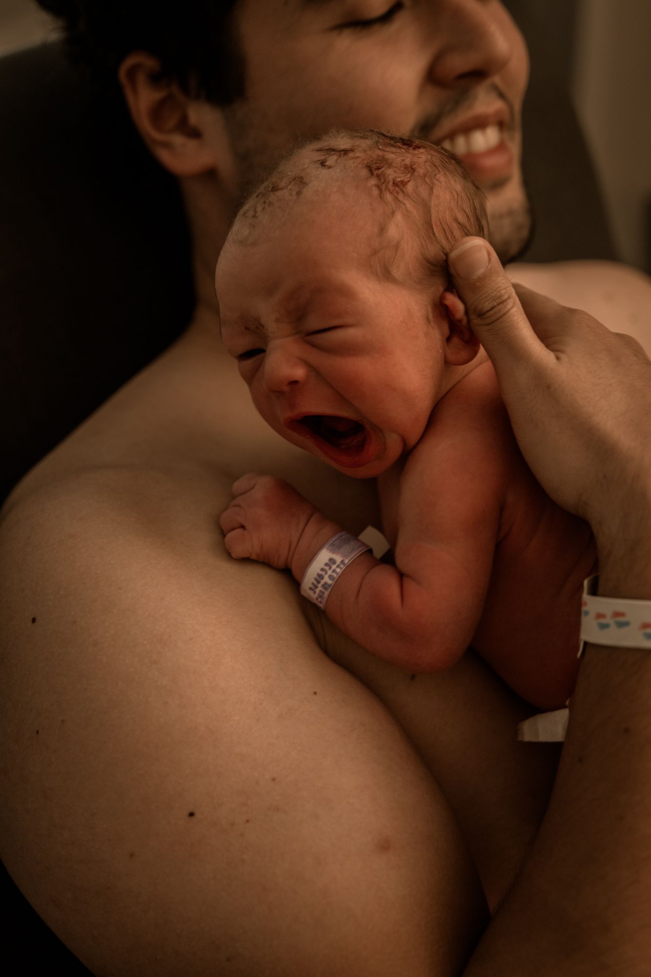 A newborn baby with an ID bracelet yawns while being cradled against someone's chest in warm lighting.
