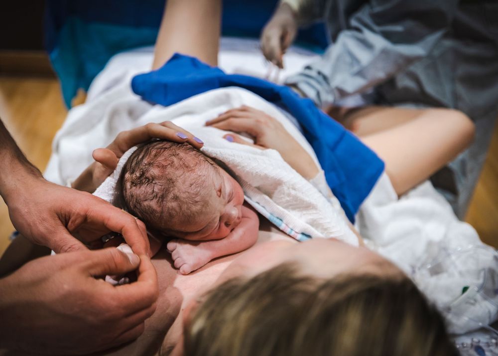 Newborn baby being examined by medical staff immediately after birth.