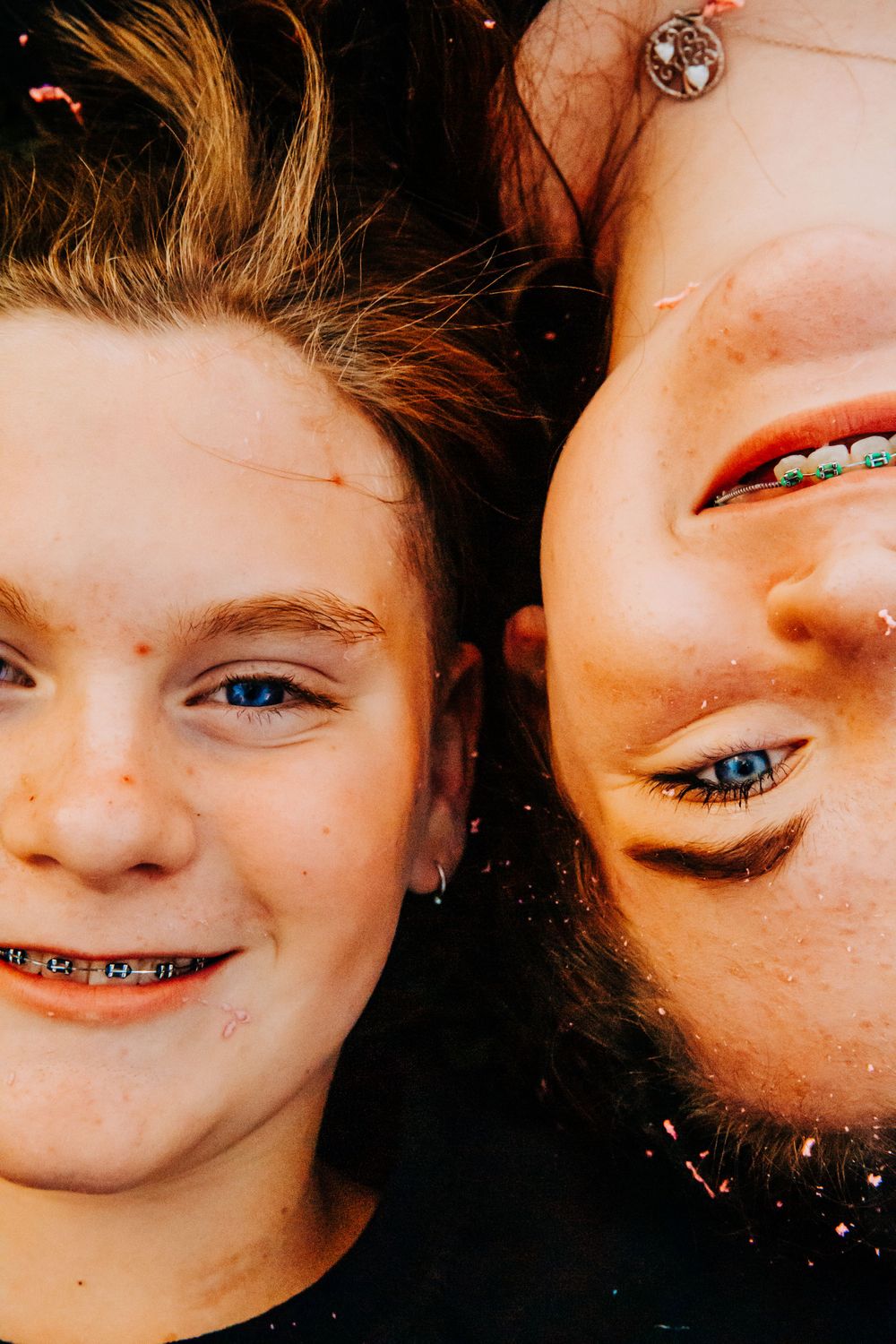 Close-up portrait of two friends with braces smiling and showing their orthodontic work.