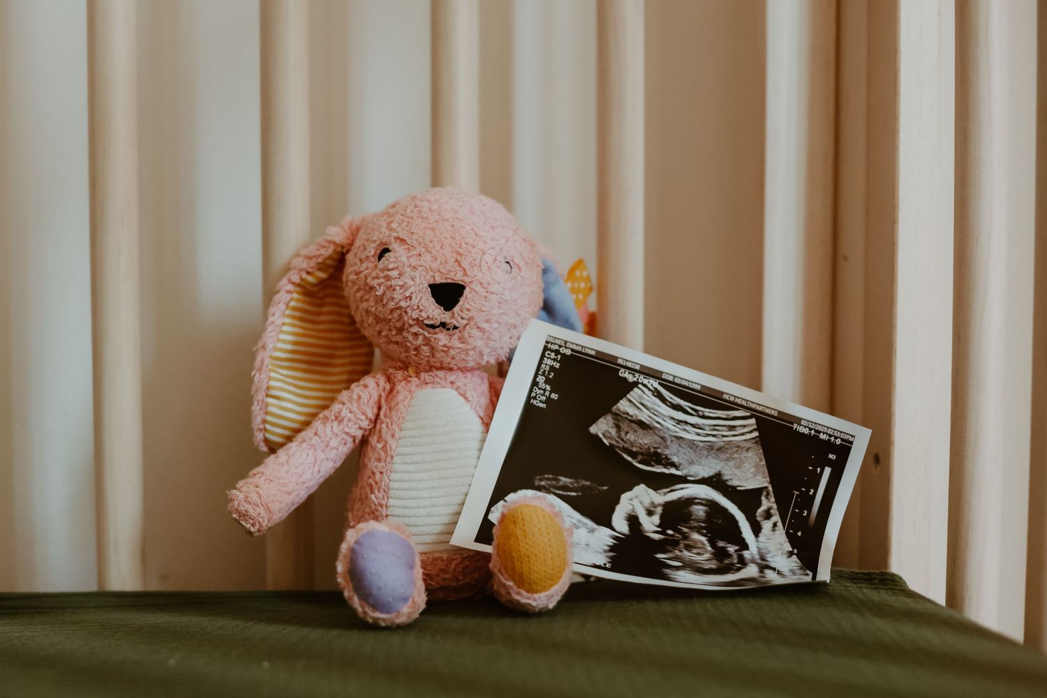 Pink stuffed bunny toy sits next to ultrasound photo on green surface against beige striped background.