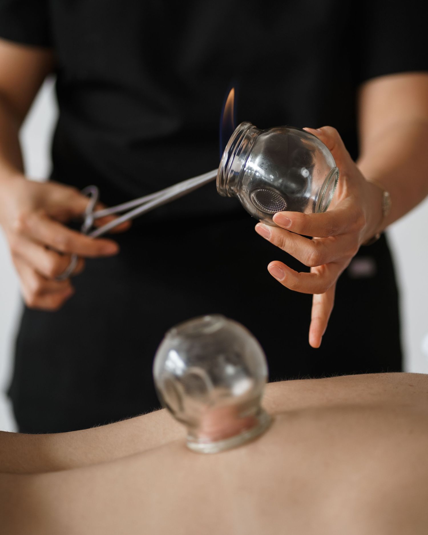 Therapist performing cupping therapy treatment with glass cups on patient's back in professional wellness setting.