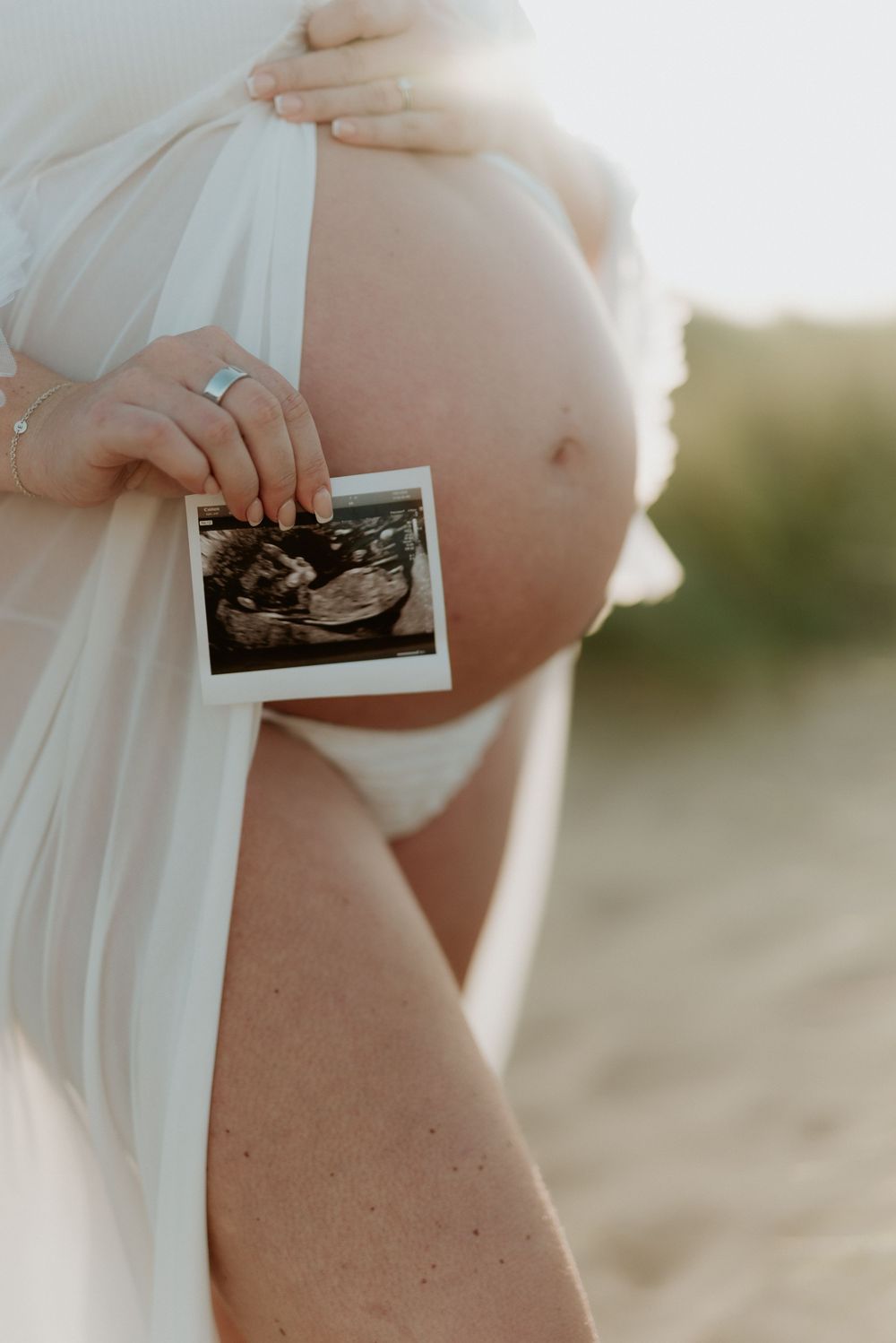 Pregnant woman in white dress holding ultrasound photo next to bare baby bump outdoors in natural light.