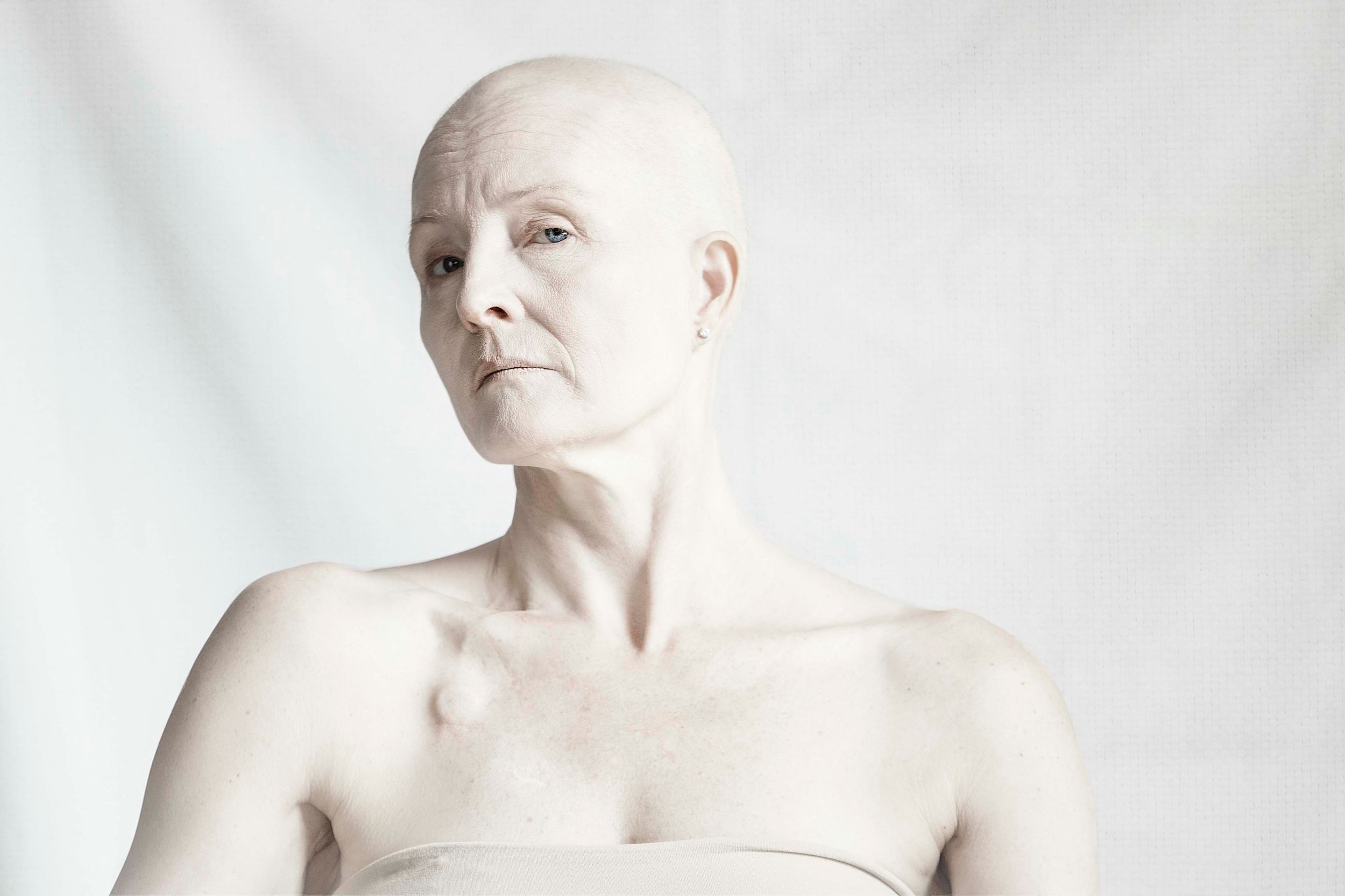 cancer treatment, chemotherapy, chemotherapy port, bald woman, portrait, fine art, healing, health, high key, copenhagen