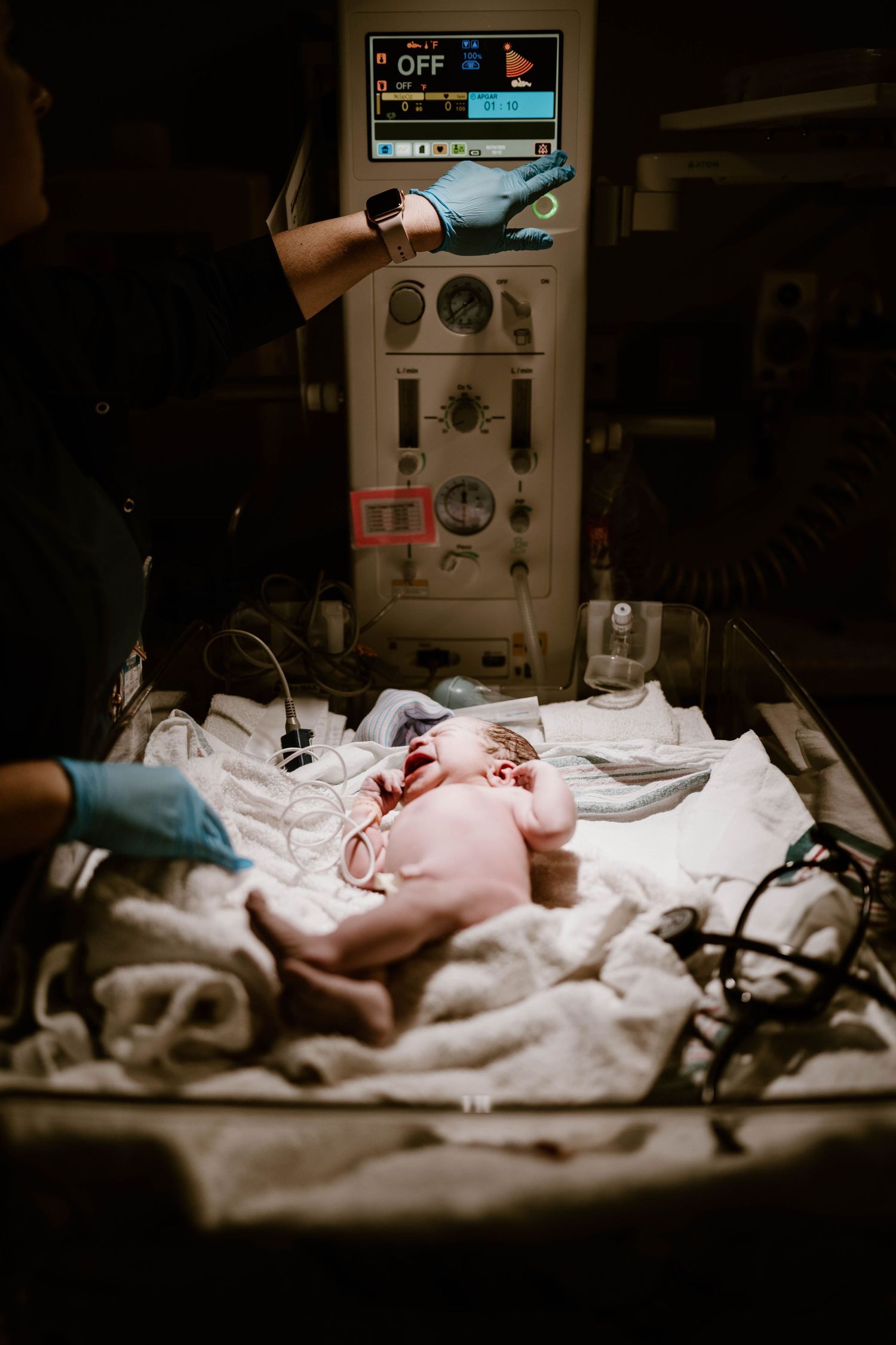 Medical equipment and monitors surround a patient lying in a hospital bed during treatment.