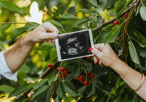 A couple holds up an ultrasound photo during a maternity session in their family orchard with cherry trees in the background