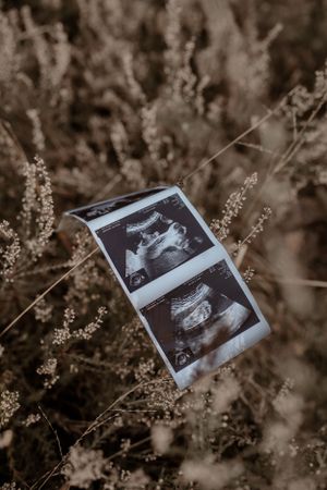 Babybauchshooting Haßloch I Pfalz I Mannheim