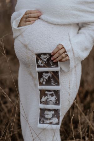 Babybauchshooting Haßloch I Pfalz I Mannheim