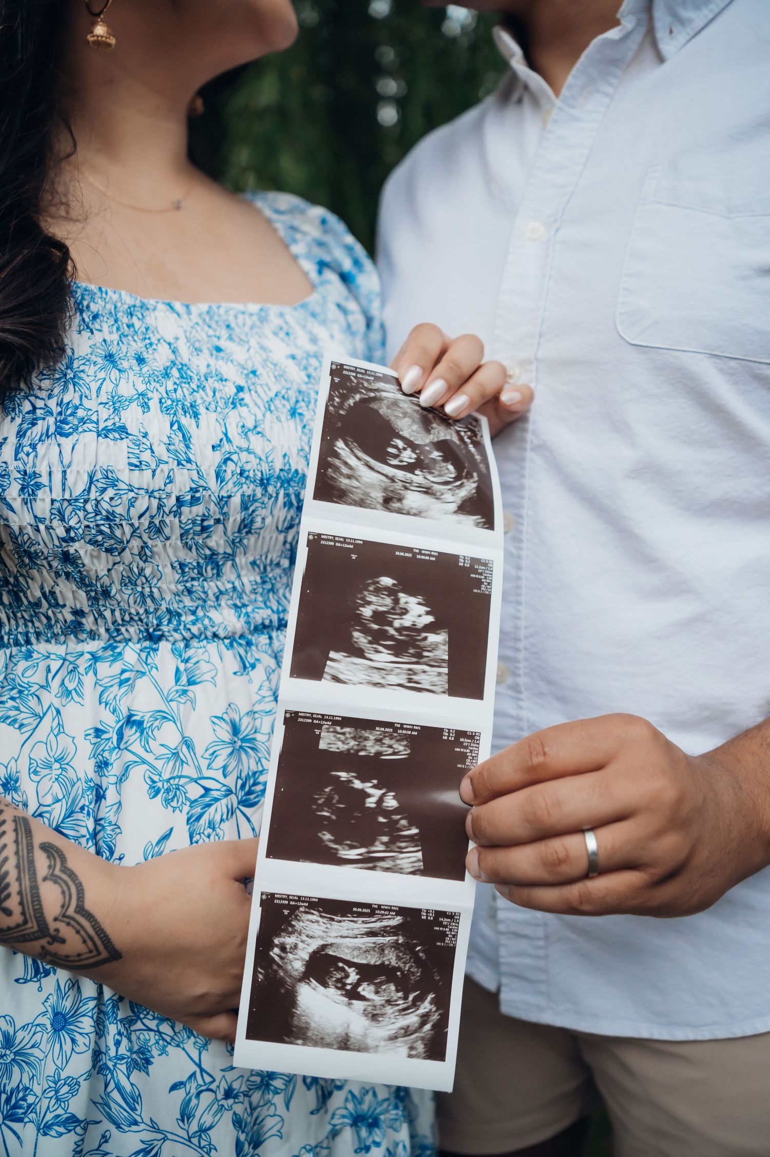 Couple holding ultrasound sonogram photos outdoors, woman in blue floral dress with tattoo, man wearing wedding ring.