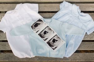 Baby announcement with white and blue onesies alongside ultrasound photos on wooden deck.