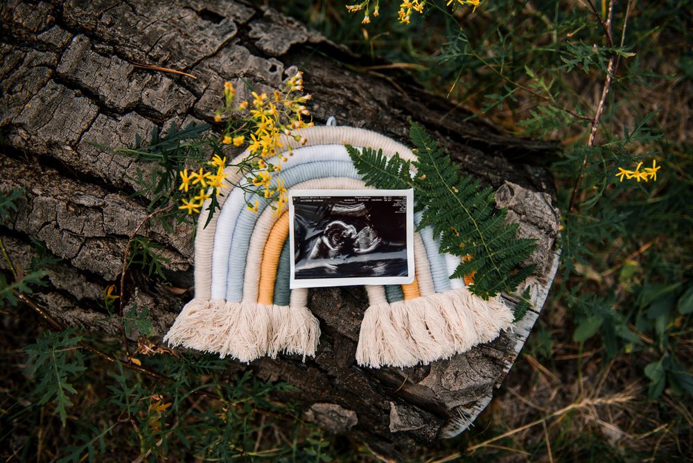 Baby items and a sonogram photo arranged on a rustic log in a forest setting.