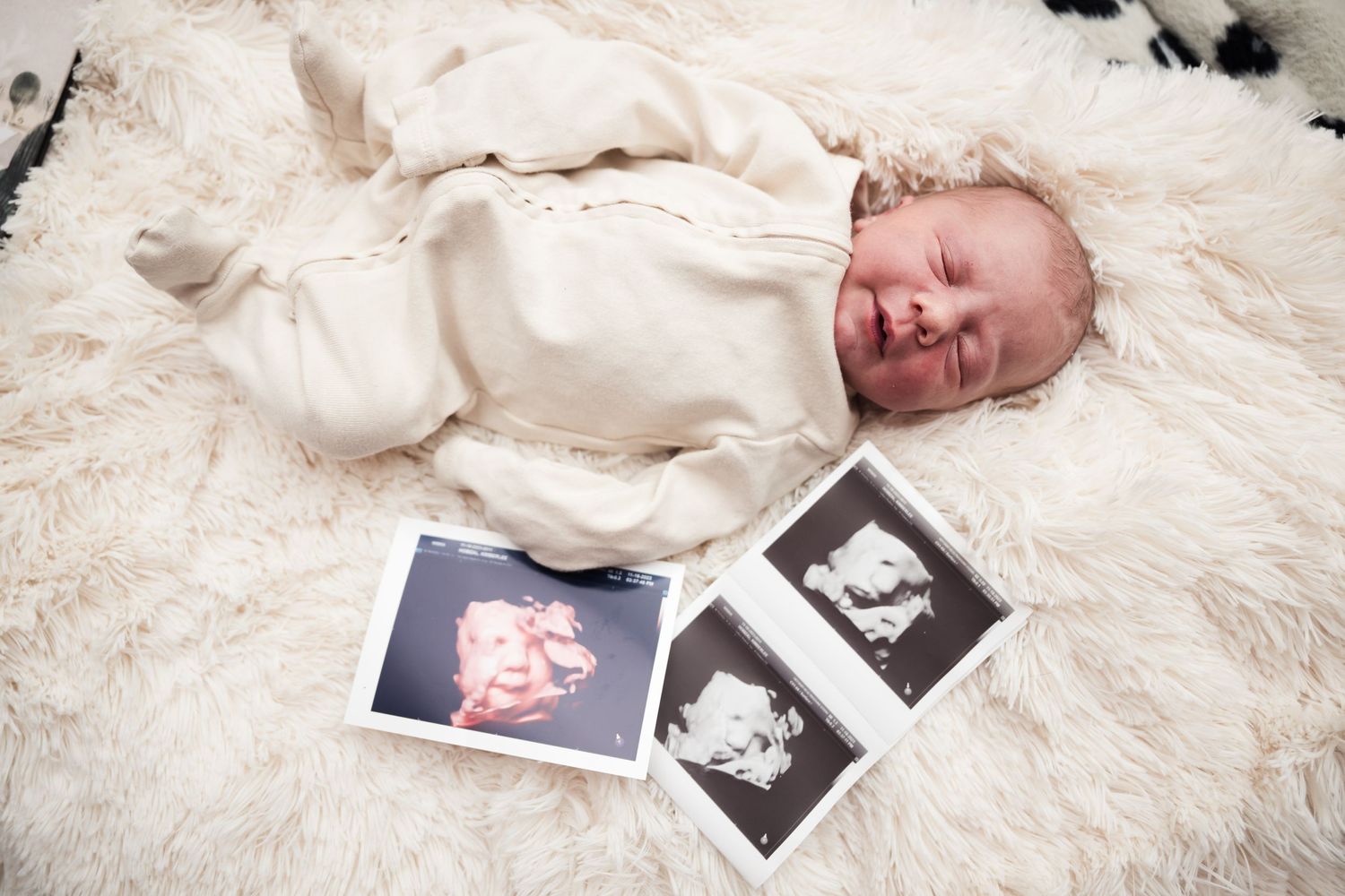 Newborn baby sleeping on fluffy white rug beside ultrasound sonogram photos.