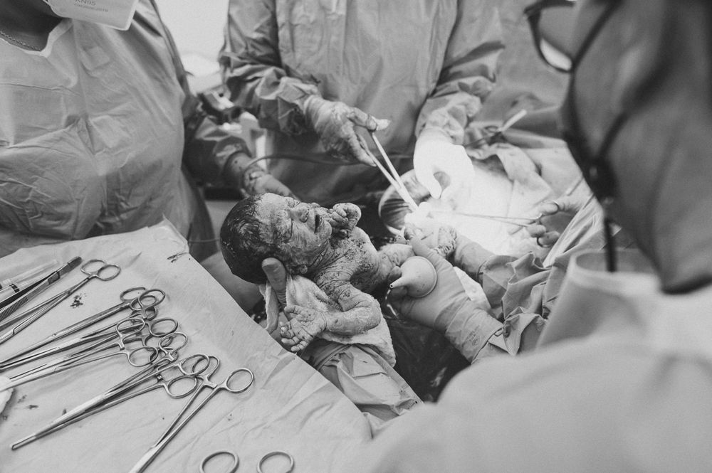 Black and white medical procedure photo with surgical instruments.