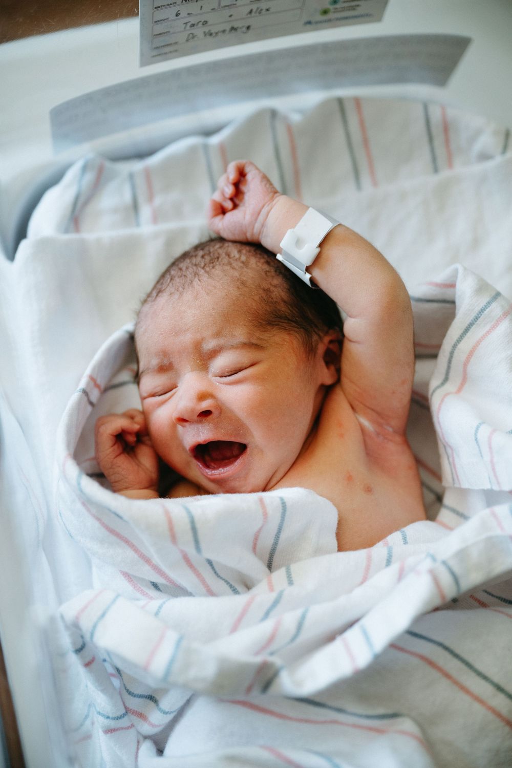 Crying newborn baby with hospital bracelet stretching arms in striped swaddle blanket.